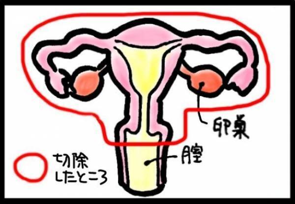＜40代で子宮がん＞「ハァハァ…」子宮全摘の翌日、激痛で息ができない！姉にSOSを出すと…！？