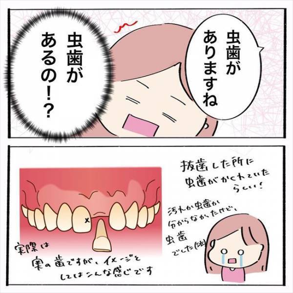 ＜歯列矯正＞「ぴえん」いざ歯並びの確認へ！ところが予想外の展開に…？！