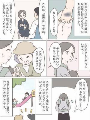 子どもの足に蒙古斑が！？周りにアザのことを聞かれるたび悩むようになり…