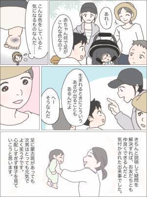 子どもの足に蒙古斑が！？周りにアザのことを聞かれるたび悩むようになり…