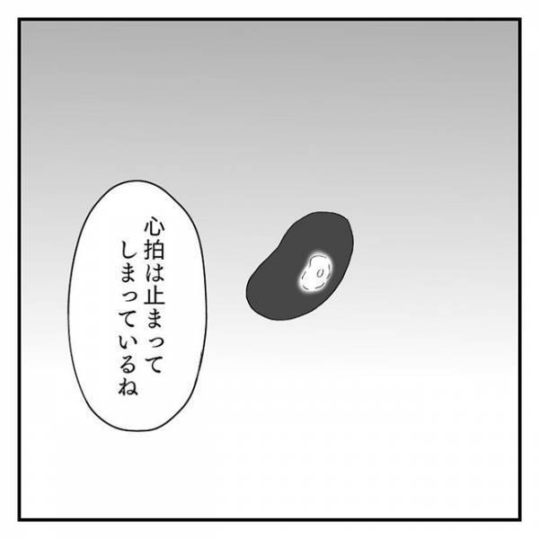 「心臓が止まってしまった」医師から告げられた、受け入れがたい事実 #流産のはなし 9