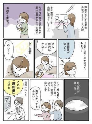 「突然、目が見えない状態に」出産から1年後、原田病を発症。子どもの顔もよく見えず…