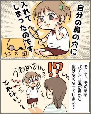 鼻の中へ入れたパチンコ玉が抜けなくなった4歳児→あわてて耳鼻科へ駆け込んだ結果！？