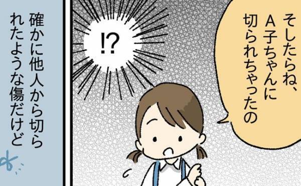 「え！？ 友だちに刃物で切られた？」娘の指に切り傷が！ びっくりして幼稚園に相談した結果