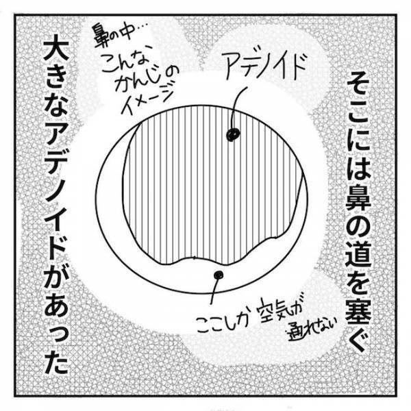 ＜2歳児の手術入院＞「うぎゃあ！」嫌がる息子を羽交い締めして耳鼻科を受診したらまさかの事態に…