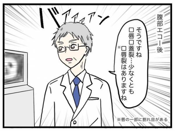 「我々が危惧しているのは…」検査のため大きい病院へ。医師からは驚きの発言＜口唇口蓋裂＞