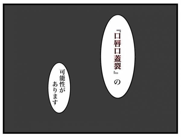 「落ち着いて聞いてください」妊婦健診で医師に告げられた衝撃の言葉とは＜口唇口蓋裂＞