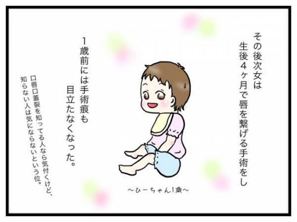 「妊娠中に抱えていた不安は…」両側性唇顎裂の娘を出産。母が娘に伝えたい言葉とは