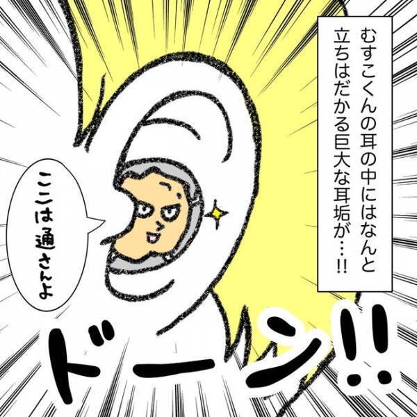 「耳の中に何かいる…！？」まるで岩！息子の耳の中から出てきたものは？