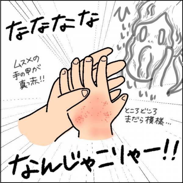 「痛いよ～！」と泣く娘の手を見て驚愕！原因はコロナ禍特有の習慣だった…！？