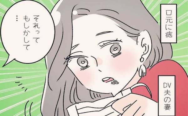 「それってもしかして…」息子の頭突きでできた傷。勘違いされてしまったら困ると思った母は？