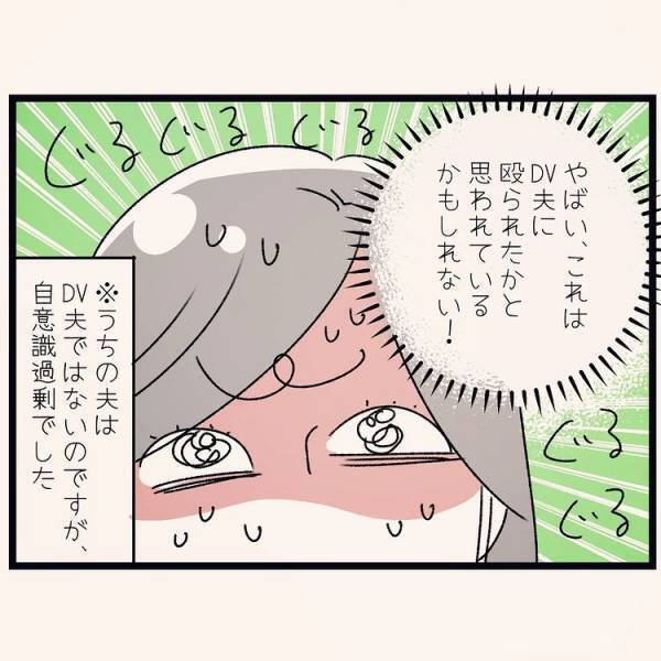 「それってもしかして…」息子の頭突きでできた傷。勘違いされてしまったら困ると思った母は？