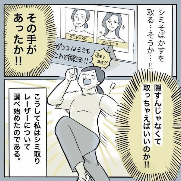 ＜シミ取りレーザー＞「私はトリミング…っと」濃いシミが憎い！子どもとの写真が見せられない
