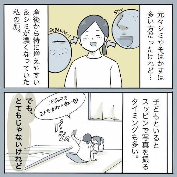 ＜シミ取りレーザー＞「私はトリミング…っと」濃いシミが憎い！子どもとの写真が見せられない