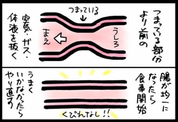 ＜40代で子宮がん＞「さすがに100万円はいかないよね？」看護師さんに概算を出してもらうと！？