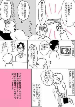 ＜ミレーナで人生変わった＞「生理？なにそれおいしいの？」装着して1年。生活に驚きの変化が！