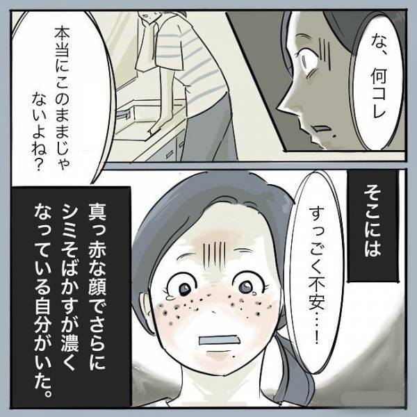 ＜シミ取りレーザー＞「あてますよ〜…バチンッ」痛ぁっ！レーザー施術開始。この痛みはまさに？！