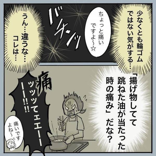 ＜シミ取りレーザー＞「あてますよ〜…バチンッ」痛ぁっ！レーザー施術開始。この痛みはまさに？！