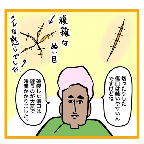 ＜ワンオペ育児と緊急搬送＞「破裂！？」頭の傷が複雑だと言われて、夫はパニックになってしまい？