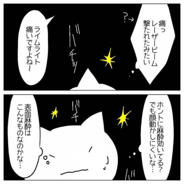 ＜顔のシミ取り＞「バチッバチッ」ん？麻酔効いてる？レーザーを当てられた瞬間ヒヤリとして