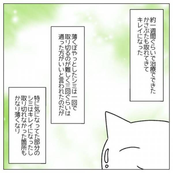 ＜顔のシミ取り＞「バチッバチッ」ん？麻酔効いてる？レーザーを当てられた瞬間ヒヤリとして