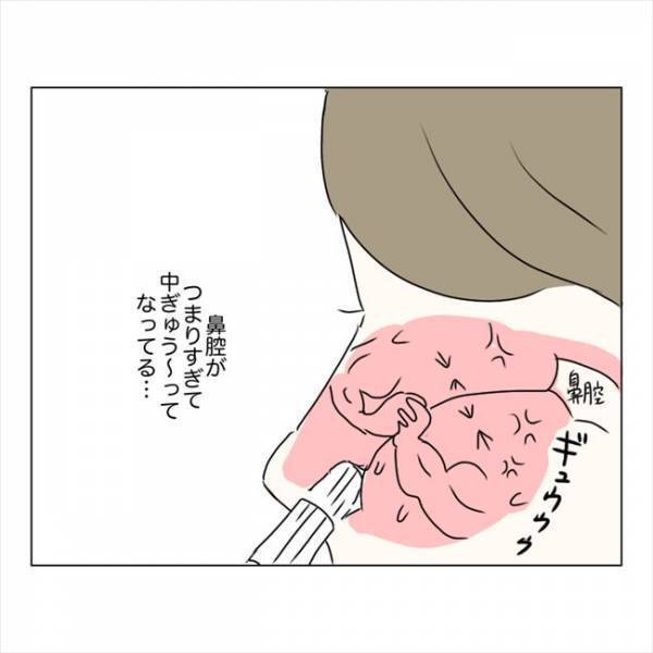 ＜鼻づまりで手術＞「もはや飾り」鼻腔が機能停止。息も吸えない現実に私は？！