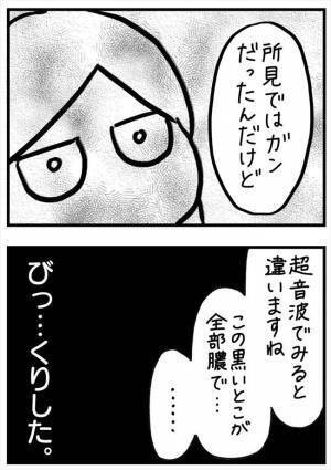 ＜PMSが乳腺炎＞「所見ではガン」医師のひと言に唖然。乳房痛の原因はまさかの？！