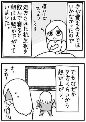 ＜PMSが乳腺炎＞「早く切って…」胸には膿。さらに発熱や悪寒も。乳腺炎がつらすぎる