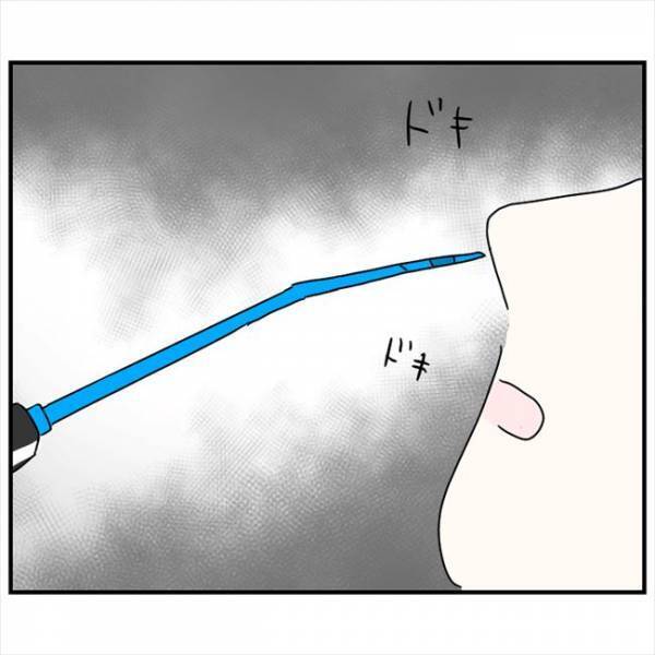 ＜鼻づまりで手術＞「不思議なにおい…」いざレーザー照射。すると、鼻腔に驚きの変化が！