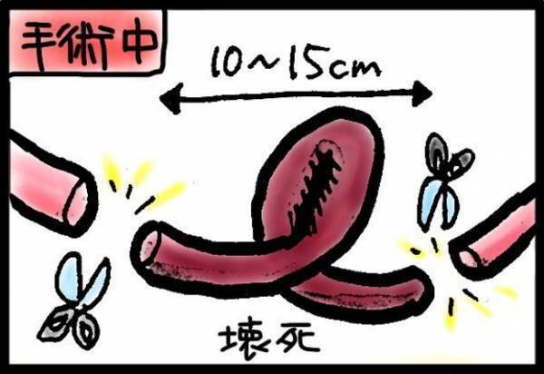 「まさか人生で3回もおなかを切るなんて」強烈な腹部の痛みの原因は？＜40代で子宮がん＞