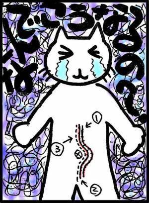 「まさか人生で3回もおなかを切るなんて」強烈な腹部の痛みの原因は？＜40代で子宮がん＞