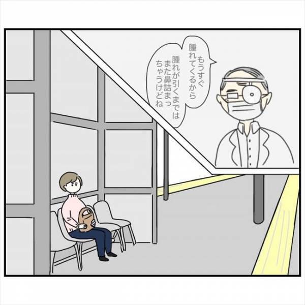 ＜鼻づまりで手術＞「鼻がスーッ」私の鼻が帰ってきた…鼻レーザーってすごない？！