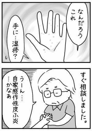 ＜PMSが乳腺炎＞「え…なにこれ」手術で膿を出し数日後、体にある異変が起き？！