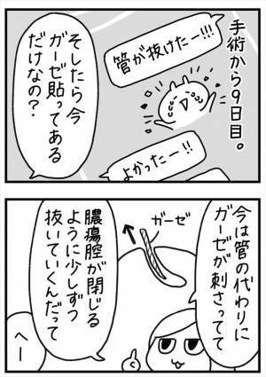 ＜PMSが乳腺炎＞「ズキ…ズキ…」いつまでも痛むのはなぜ？治療の終わりが見えない