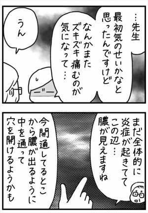 ＜PMSが乳腺炎＞「ズキ…ズキ…」いつまでも痛むのはなぜ？治療の終わりが見えない