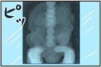 「腹痛の原因は…」そんなまさか！医師の口から出た答えとは！？＜おなかの中身は？＞
