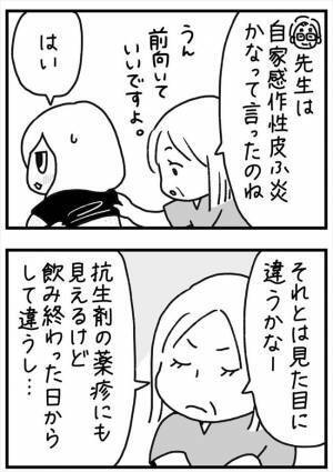 ＜PMSが乳腺炎＞「ひええ…」全身に湿疹！その原因はまさかの？！