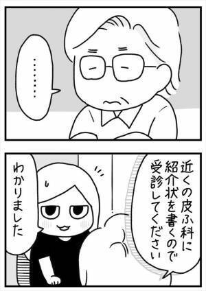 ＜PMSが乳腺炎＞「ひええ…」全身に湿疹！その原因はまさかの？！