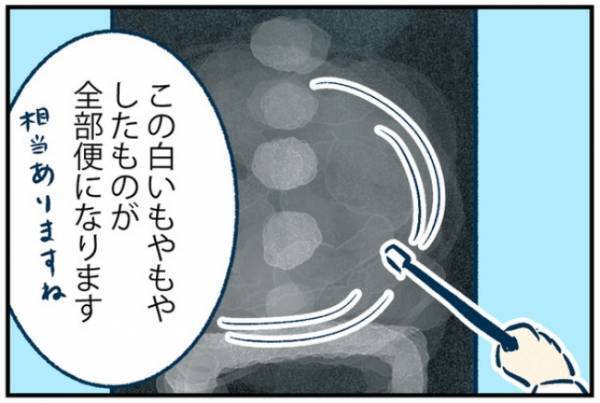 「白いモヤモヤしたものは…」ヒィィィ！おなかの中身に驚愕！＜おなかの中身は？＞