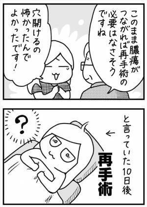 ＜PMSが乳腺炎＞「大人もなるの？！」想定外の診断に驚き。そして気になる胸の状態は？！