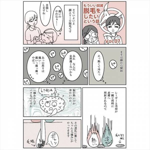 ＜毛をなくしたい＞「アッ痛い！」ピッピッ。レーザーを下半身に当てられた瞬間に！？