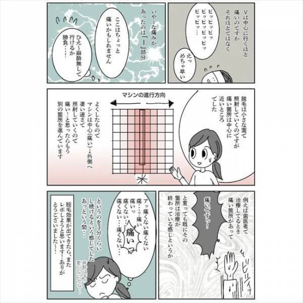 ＜毛をなくしたい＞「アッ痛い！」ピッピッ。レーザーを下半身に当てられた瞬間に！？