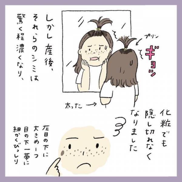 ＜アラフォーシミ取り＞「もう隠せない」産後のシミがエグい…化粧じゃどうにもならなくて？！