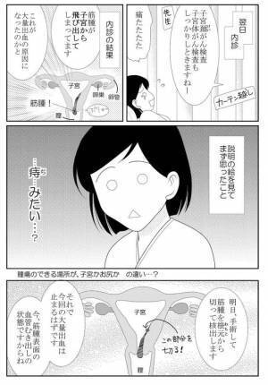 ＜子宮の腫瘍が飛び出した＞「子宮から親指大のものが飛び出してます」内診で衝撃の事実が判明し！？