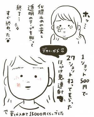 【経過写真あり】「消すのダルい」産後にシミ激増。レーザー治療6日後に驚きの変化が！