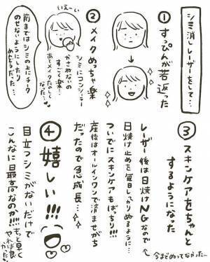 【経過写真あり】「消すのダルい」産後にシミ激増。レーザー治療6日後に驚きの変化が！