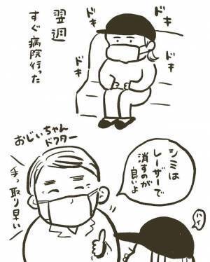 【経過写真あり】「消すのダルい」産後にシミ激増。レーザー治療6日後に驚きの変化が！