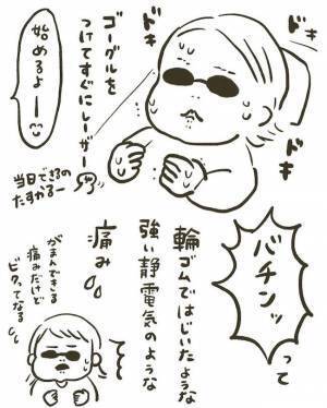 【経過写真あり】「消すのダルい」産後にシミ激増。レーザー治療6日後に驚きの変化が！