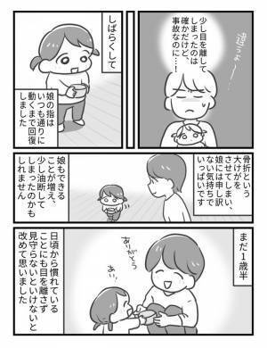 「えっ、まさか虐待を疑われた！？」医師の言葉にドキッ！娘のけがを見て言われたひと言とは？