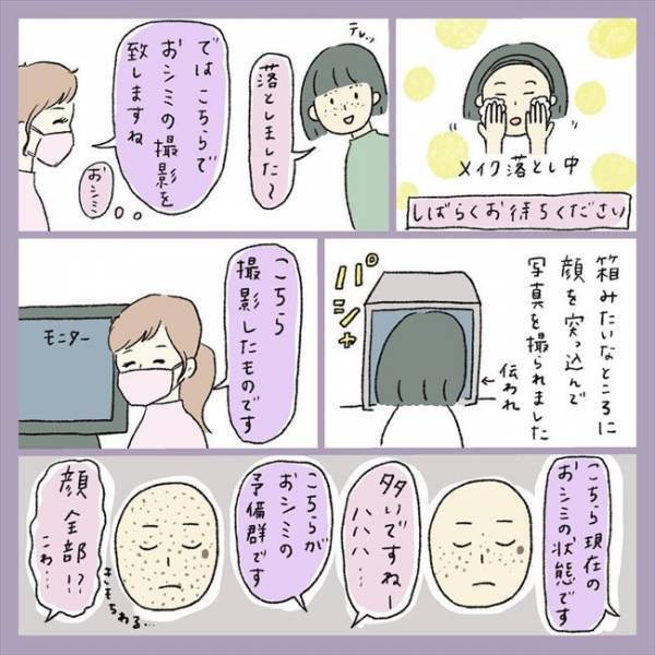 ＜アラフォーシミ取り＞「そんなにするの？！」シミ多めのレーザー治療費に驚愕！